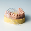 Zahnmodell mit einer transparenten Schiene für Zahnkorrektur und Zahngesundheit.