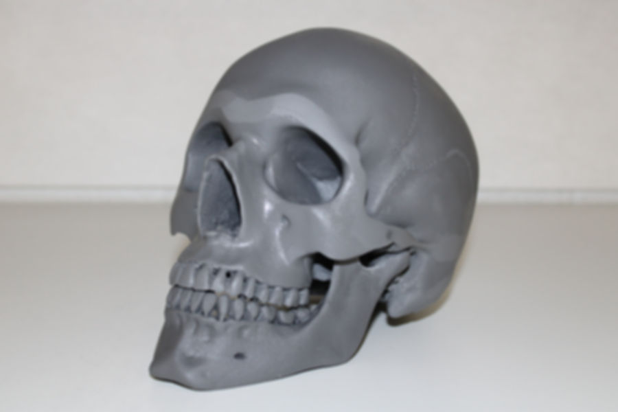 Non-Fractured Skull