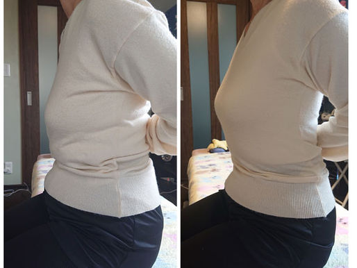 肩こり、頭痛、背中の痛み…体もこんなに歪んでました(>o<)