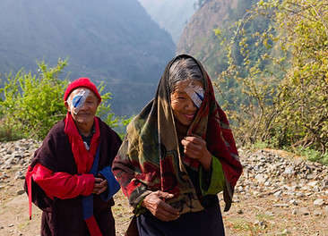 2025_Bihi Eye camp-0498.jpg