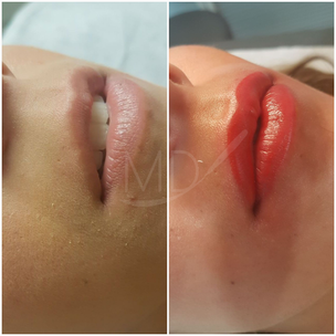 Micropigmentacion labios Barcelona 2.png