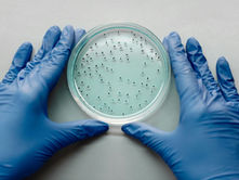 Gloved hands holding a Petri dish with small black specks on a light blue medium, set against a neutral surface.