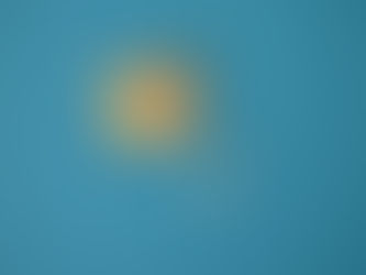 Metoprolol Succinate Tablet: Uses, Dosage, Benefits, and Safety