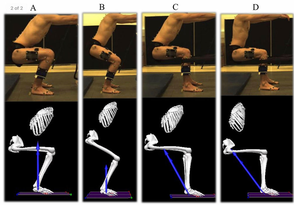 Fix Your Jumper’s Knee with These 3 Easy Exercises Comprehensive Chiropractic Resources