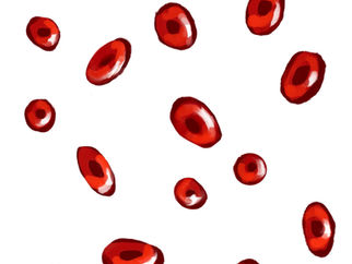 Chronic Fatigue as a Symptom: Recognizing Iron Deficiency Anemia in Women
