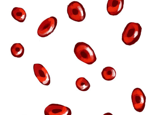 Chronic Fatigue as a Symptom: Recognizing Iron Deficiency Anemia in Women
