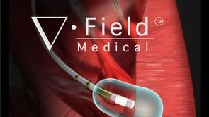 Farapulse founder’s Field Medical partners with CardioNXT on novel pulsed-field ablation tech