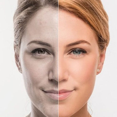 Skin-boosters.jpg