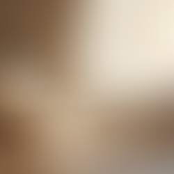 Eye Movement Desensitization and Reprocessing (EMDR) Therapy