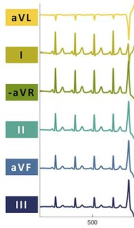 Principle-of-polyphonic-sonification-of-