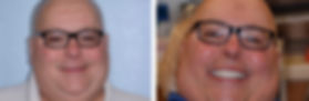 Mike proudly smiling after his dental implant surgery