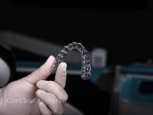 a picture of Klär clear aligners held in hand