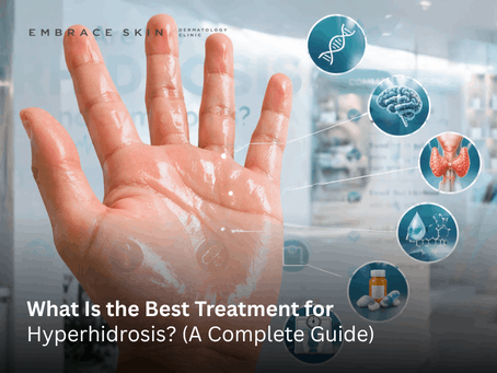 What Is the Best Treatment for Hyperhidrosis?