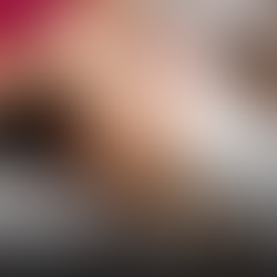 Woman receiving microneedling treatment in spa setting. Text reads: "How Long Do Microneedling Results Last?