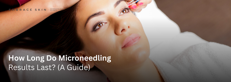 Woman receiving microneedling treatment in spa setting. Text reads: "How Long Do Microneedling Results Last? (A Guide).""