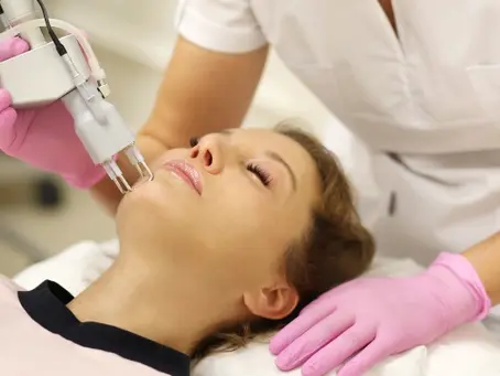 Seasonal Guide: When Is the Best Time to Get Laser Treatments