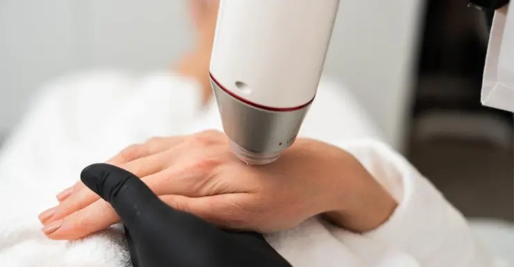 Laser for Aging