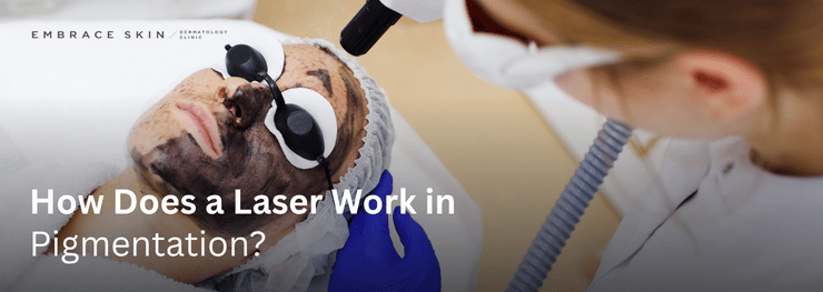 Person receiving laser skin treatment wearing protective goggles. Text: How Does a Laser Work in Pigmentation? Setting is a clinic.