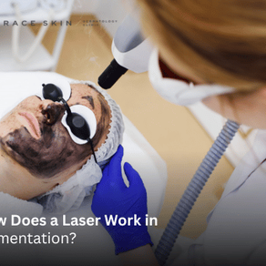 Laser Work in Pigmentation