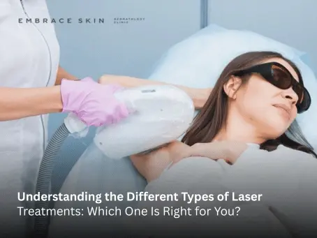 Types of Laser Treatments