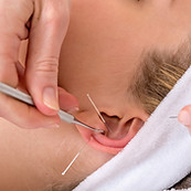 Auriculotherapy.jpeg