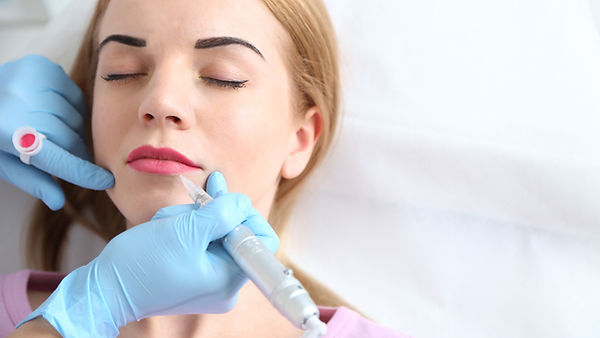 מילוי שפתיים