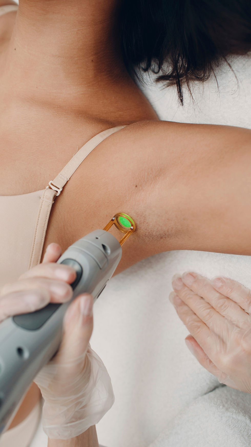 High angle view of laser hair removal treatment on underarm area