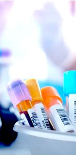 INSUMOS Y ACCESORIOS