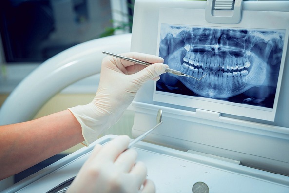 dental-radiology1.jpg