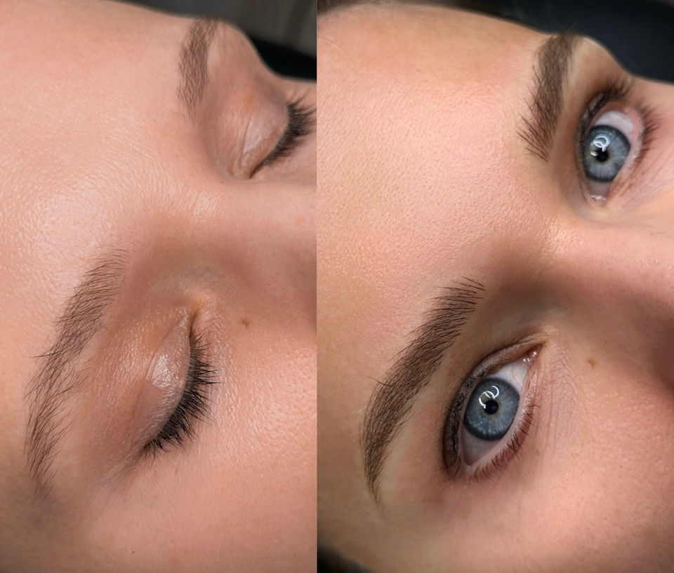 before - after combo brows