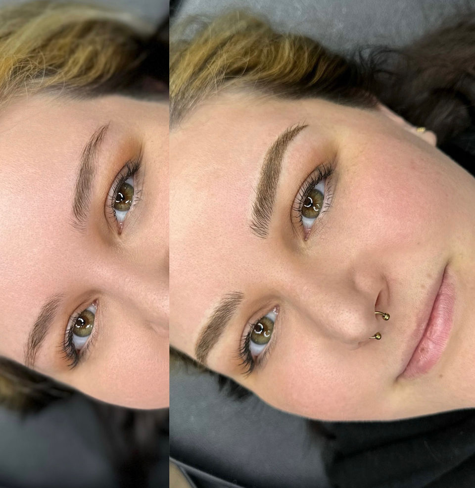 before - after fusion brows