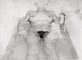 Drawing by Antonio López, Woman in the Bathtub, 1971