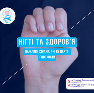 Що нігті можуть розповісти про стан здоров’я