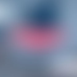 Часті набряки: сигнал про проблему