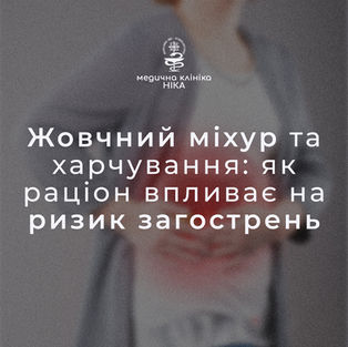 Жовчний міхур і харчування: що провокує напади