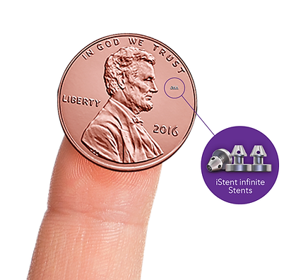 iStent-infinite-penny-images-wn5f5c.png