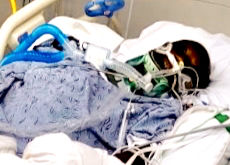 Greenville Tree Trimmer Recovers From 40-Foot Fall
