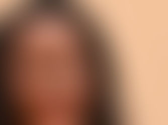 Outbreaks of measles have the US on the brink of losing its elimination status