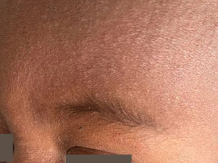 DPH investigates measles exposure in three Greenville locations