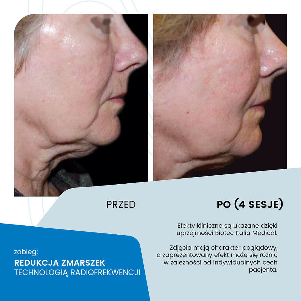 Rewolucja 2025 w Infinite Beauty:    Poznaj Przełomowe Zabiegi, które Zmieniają Reguły Gry...