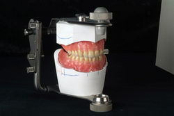 full denture on an articulator