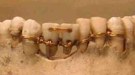 Ancient dentistry...wow!