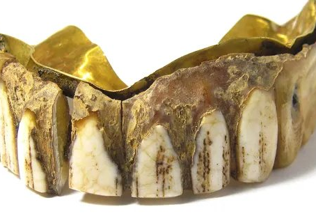 Did you know dentures have been around for this long??