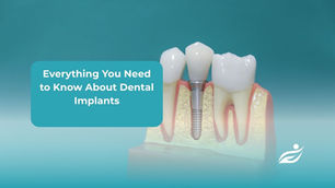 Dental implant model shows tooth structure. Text reads "Everything You Need to Know About Dental Implants". Turquoise background.
