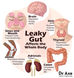 What is a Healthy Gut?