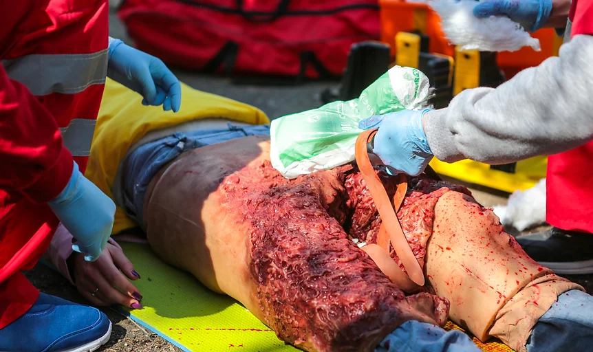 firstaiders rescuing a patient with amputated le in norwich