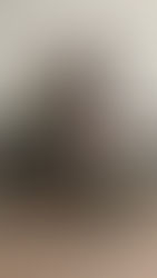 Working together in the clinic on our intensive Multiple Sclerosis programme, and diligently at home on our Remote Support programme, Ashley's overall spasticity is reducing including at night, so she is getting more restful sleep.