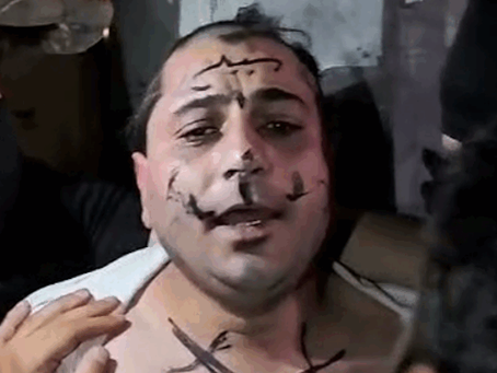 Aleppo: Syrian Singer Publicly Humiliated and Assaulted by Militant Group Over Past Support for Assad