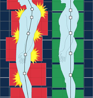 The Crucial Role of Posture in Health and Well-being: A Comprehensive Exploration