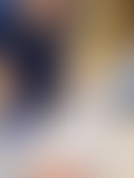 Acupuncturist Michelle using moxibustion to enhance acupuncture results for seasonal allergy relief in East Texas